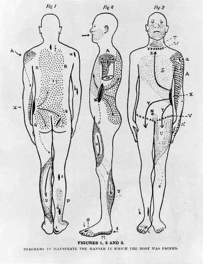 Diagram showing method of packing for mummification