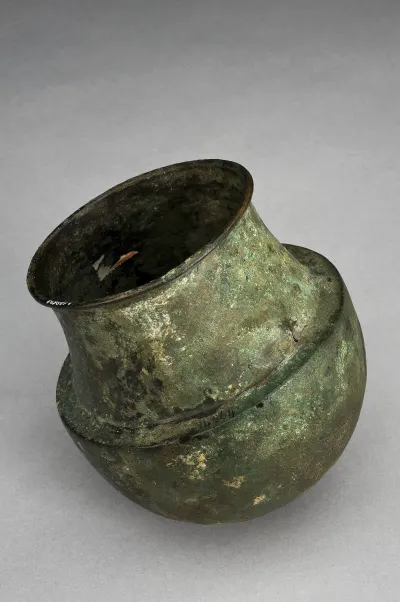 A bronze cupping vessel, 300 BCE to 300 CE. Heated and applied to the skin, vessels like this were central to the ancient practice of cuppin
